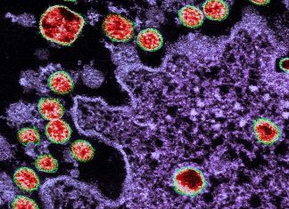 Why is SARS-CoV-2 deadly and different?
