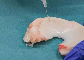 New injectable gel that can repair tears resulting from an accident or trauma