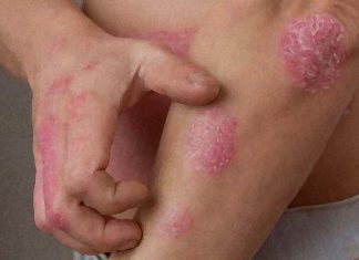 New wearable sensor can quantifies itch