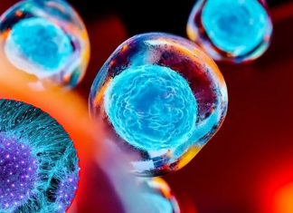 Adipose cells are plentiful source of stem cells for use in spinal fusion surgeries