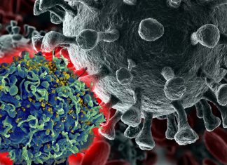 Individuals living with HIV and AIDS have an increased risk of SARS-CoV-2 infection and fatal outcomes from COVID-19