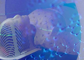 Alzheimer: basse dosi di radiazioni possono migliorare la qualità della vita
