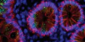Natural immunity to SARS-CoV-2 appears to confer a protective effect for at least a year