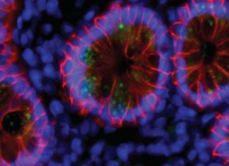 Natural immunity to SARS-CoV-2 appears to confer a protective effect for at least a year