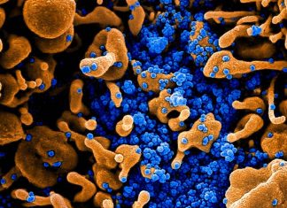 Novel chip-based antigen can provide ultrasensitive detection of SARS-CoV-2 and influenza A