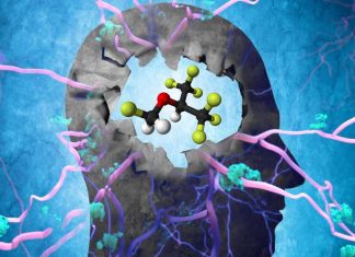 Sevoflurane anesthetic may affect tau spread in the brain to promote Alzheimer’s disease pathology