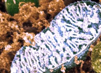 Shortage of DNA building blocks triggers inflammatory reaction