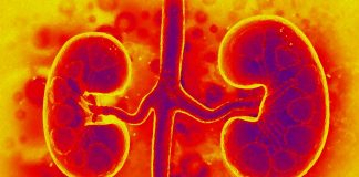 Researchers have identified an enzyme (NEDD4-2) that may help to curb chronic kidney disease