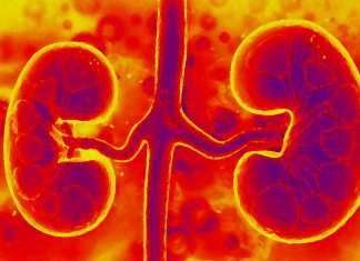 Researchers have identified an enzyme (NEDD4-2) that may help to curb chronic kidney disease