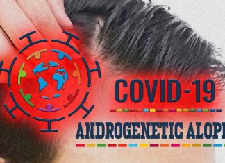Gli uomini con una forma comune di perdita di capelli sensibile agli ormoni sono più inclini a essere ricoverati in ospedale con COVID-19