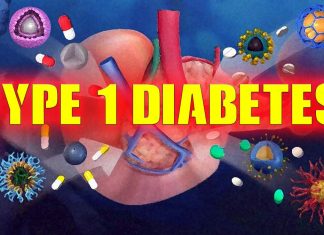 Exocrine cell dysfunction might be a major contributor of type 1 diabetes