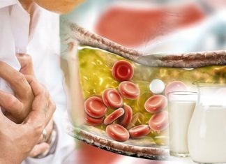 Regular consumption of milk is not associated with increased levels of cholesterol
