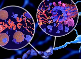 P-glycoprotein (P-gp) has the ability to remove Alzheimer’s-associated toxin from the brain