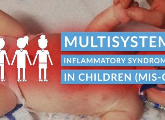 COVID-19: i corticosteroidi possono essere un trattamento efficace della sindrome infiammatoria multisistemica nei bambini (MIS-C)