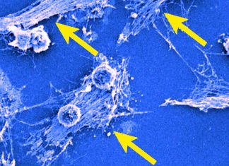 COVID-19: Neutrophils explode when they bind to such pathogens creating a sticky tangle which acts as a trap