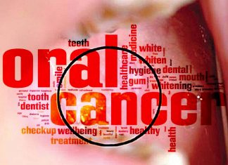 Oral cancer secretome induce the expression of a group of genes that control the vitamin D signaling pathway in T cells