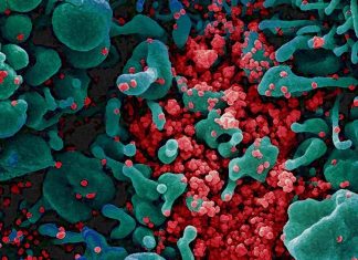 SARS-CoV-2: An immunocompromised individual tested positive on PCR for 290 days