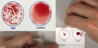 Researchers has developed a rapid blood test that could confirm a person has been vaccinated