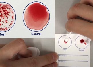 I ricercatori hanno sviluppato un esame rapido del sangue che potrebbe confermare se una persona è stata vaccinata