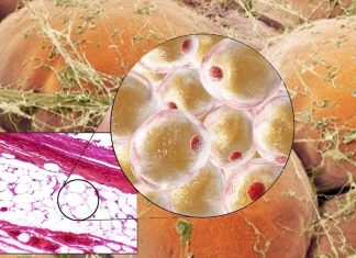 Brown fat could play an important protective role against diabetes