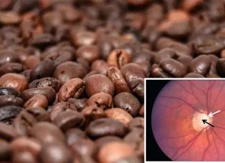 Consuming large amounts of daily caffeine may increase the risk of glaucoma