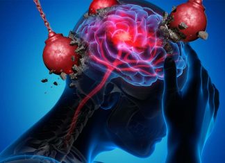 Energy impairment may cause brain oxidative stress triggering a migraine as a protective response