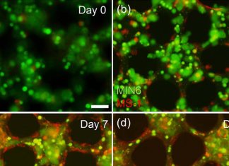 COVID-19 Sepsi: i ricercatori hanno identificato un tipo di cellula che compromette la capacità del corpo di rilevare e rispondere al virus