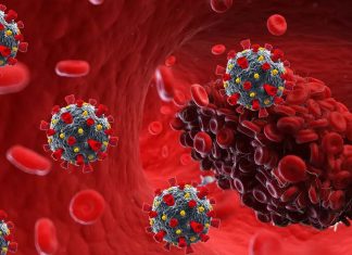 Inflammation and blood clotting in very severe cases of COVID-19 may be caused by the antibodies
