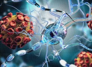 I ricercatori mostrano come SARS-CoV-2 infetta le cellule cerebrali
