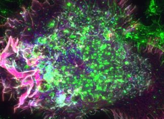 Cancer cells eat parts of the membrane surrounding themselves to survive