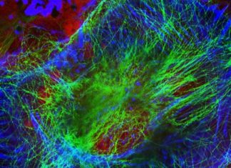 Neuroblastoma: found a way to delivery nanoparticles to treat the tumor cells