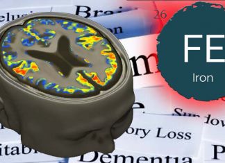 Alzheimer: regular physical exercise modulates iron metabolism in both the brain and the muscles