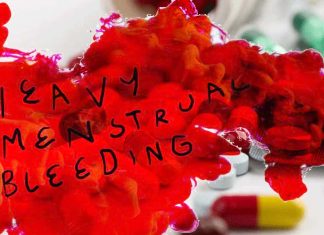 Anti-inflammatory steroid could reduce heavy menstrual bleeding
