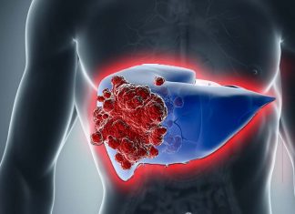 Chronic viral infections of the liver can lead to hepatocellular carcinoma