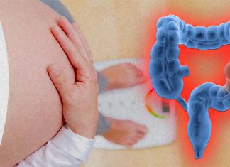 An obese mum-to-be may be raising the risk of bowel cancer in her adult children
