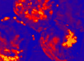 I centenari hanno un microbioma unico che può proteggerli da alcune infezioni batteriche