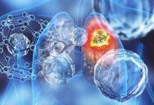 The Impact of Cardiorespiratory Fitness on Cancer Incidence and Mortality in Men