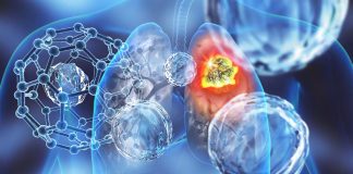 The Impact of Cardiorespiratory Fitness on Cancer Incidence and Mortality in Men