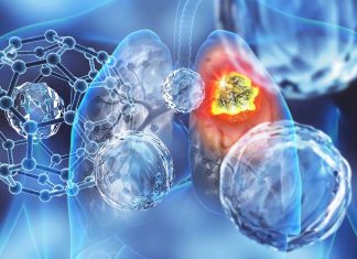 The Impact of Cardiorespiratory Fitness on Cancer Incidence and Mortality in Men