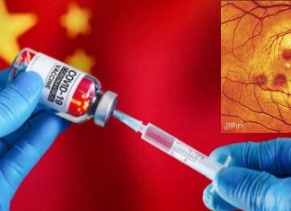 Ocular Adverse Events With China’s Sinopharm COVID-19 Vaccines