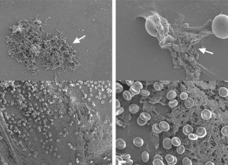 SARS-CoV-2 Alters Fibrin Clot Structures That Contributes To Thrombosis Risk In Severe COVID-19