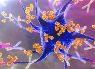 Severe COVID-19 linked to self-attacking antibodies