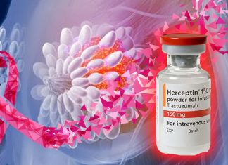 HER2 positive metastatic breast cancer: HER2-targeting antibody-drug improves 72% in progression-free survival