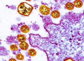 COVID-19 Induces Expression Of Unique Autoantibodies – Males At Risk For Autoimmune