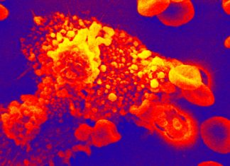 Protein CD47 Found To Be Contributing Factor To COVID-19 Disease Severity