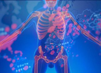 FibroCOVID: Or Fibromyalgia As A Result Of A SARS-CoV-2 Variant Infection