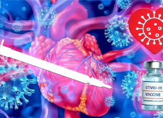 Younger male more frequently report myocarditis and pericarditis following mRNA COVID-19 vaccines
