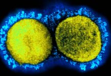 Acylation of spike of SARS-CoV-2 enhances infectivity and also fusion capacity