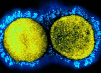 Acylation of spike of SARS-CoV-2 enhances infectivity and also fusion capacity