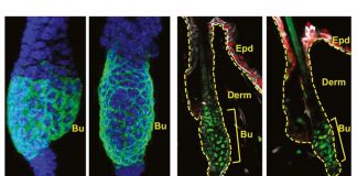 Hair loss is caused by stem cells that lose glue and escape the hair follicle